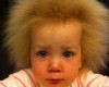 Из-за генетической аномалии девочка не может расчесать свои волосы