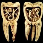 Горячий воск, исцеление луной и другие странные методы, которыми лечили зубы
