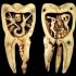 Горячий воск, исцеление луной и другие странные методы, которыми лечили зубы наши предки